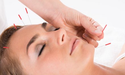 Acupuncture as natural face lift and facial botox